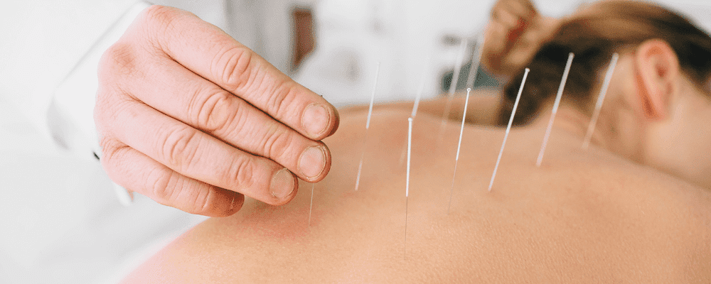acupuncture-aiguilles-dos-femme